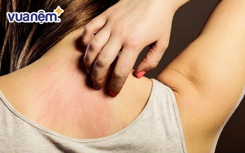 Nệm cũ gây hại lớn đến làn da nên bạn cần thanh lý nệm