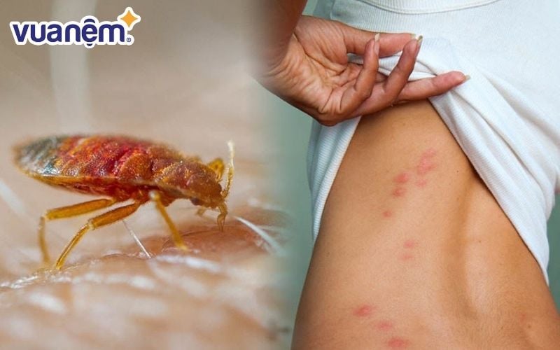 Rệp, mạt giường là loài côn trùng ký sinh chuyên hút máu